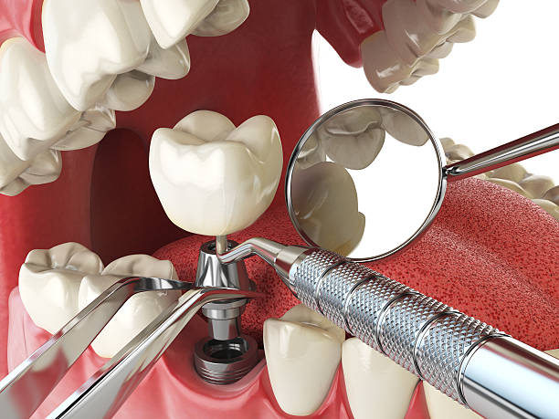 Best Emergency Dental Services for Seniors in Briarcliff Manor, NY